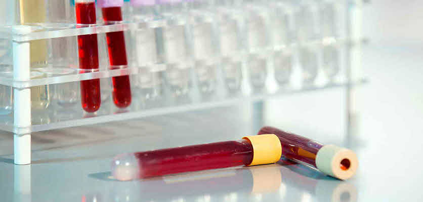 Fun facts about animal blood types
